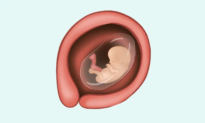 pieluchomajtki stomia geriatria